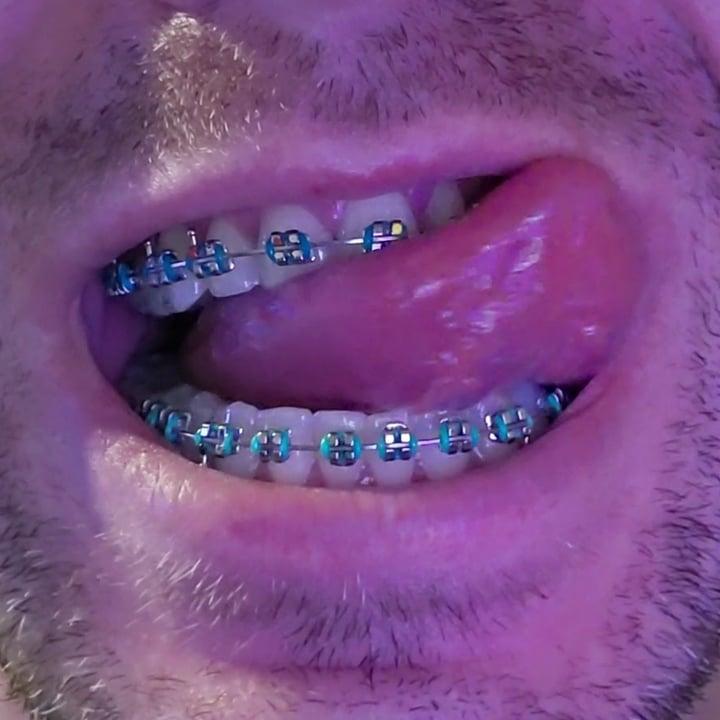 Metalmouthkiss profile picture