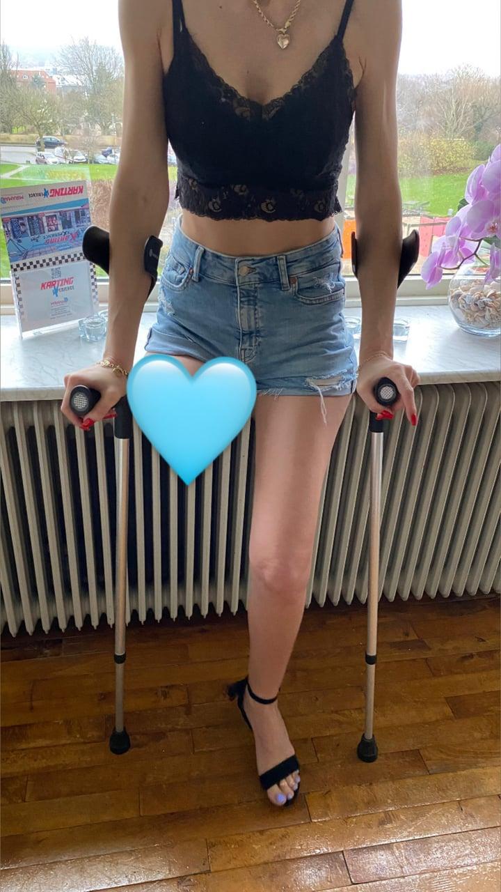 One leg 🦿Foot/stump Goddess 👸 profile picture