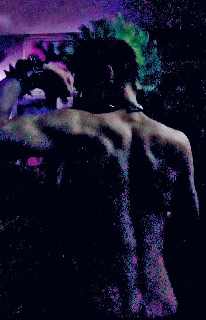 Tumor profile picture