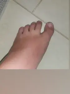 Stacy's ugly feet profile picture