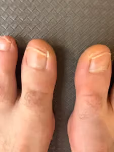 MyUglyFeetAUS profile picture