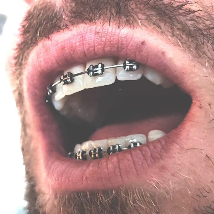 Braces profile picture